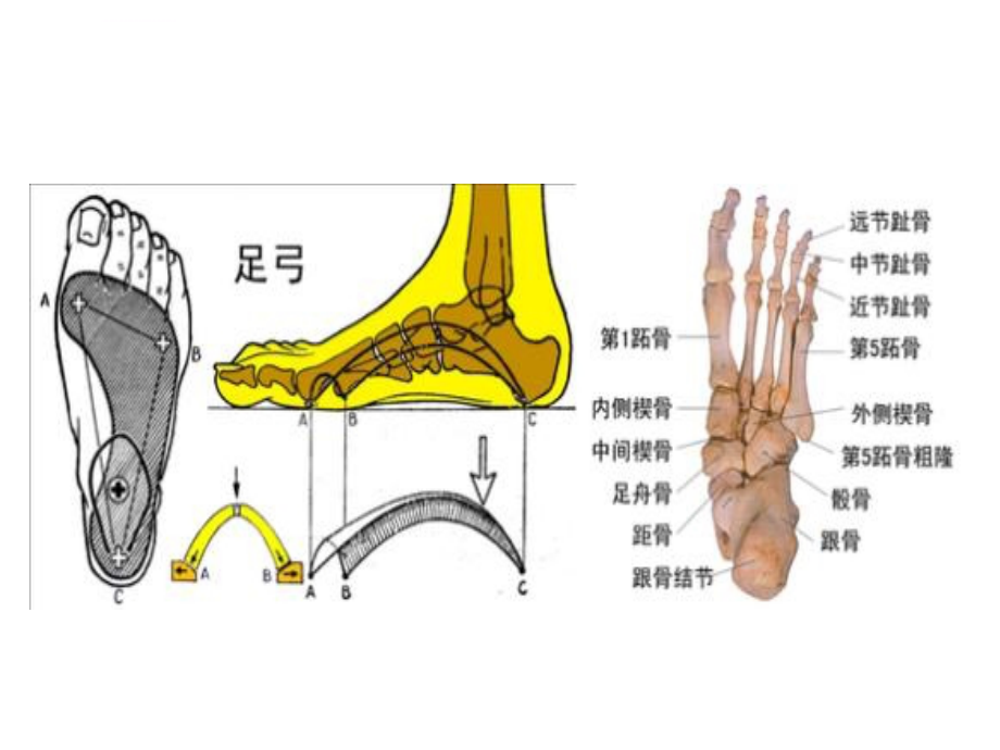 平足症的诊断和治疗-ppt课件_第2页