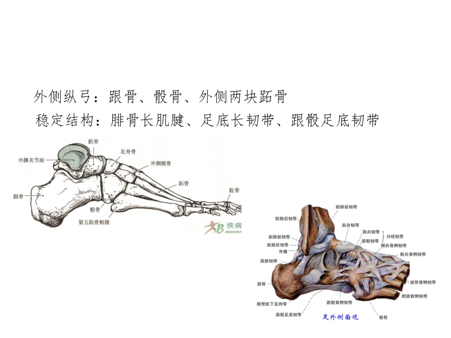 平足症的诊断和治疗-ppt课件_第4页