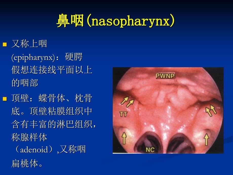 咽解剖急慢性咽炎 (2)3教学教案_第5页