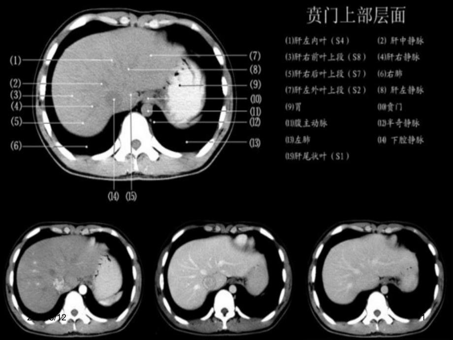 小时读懂腹部CT讲座_第1页