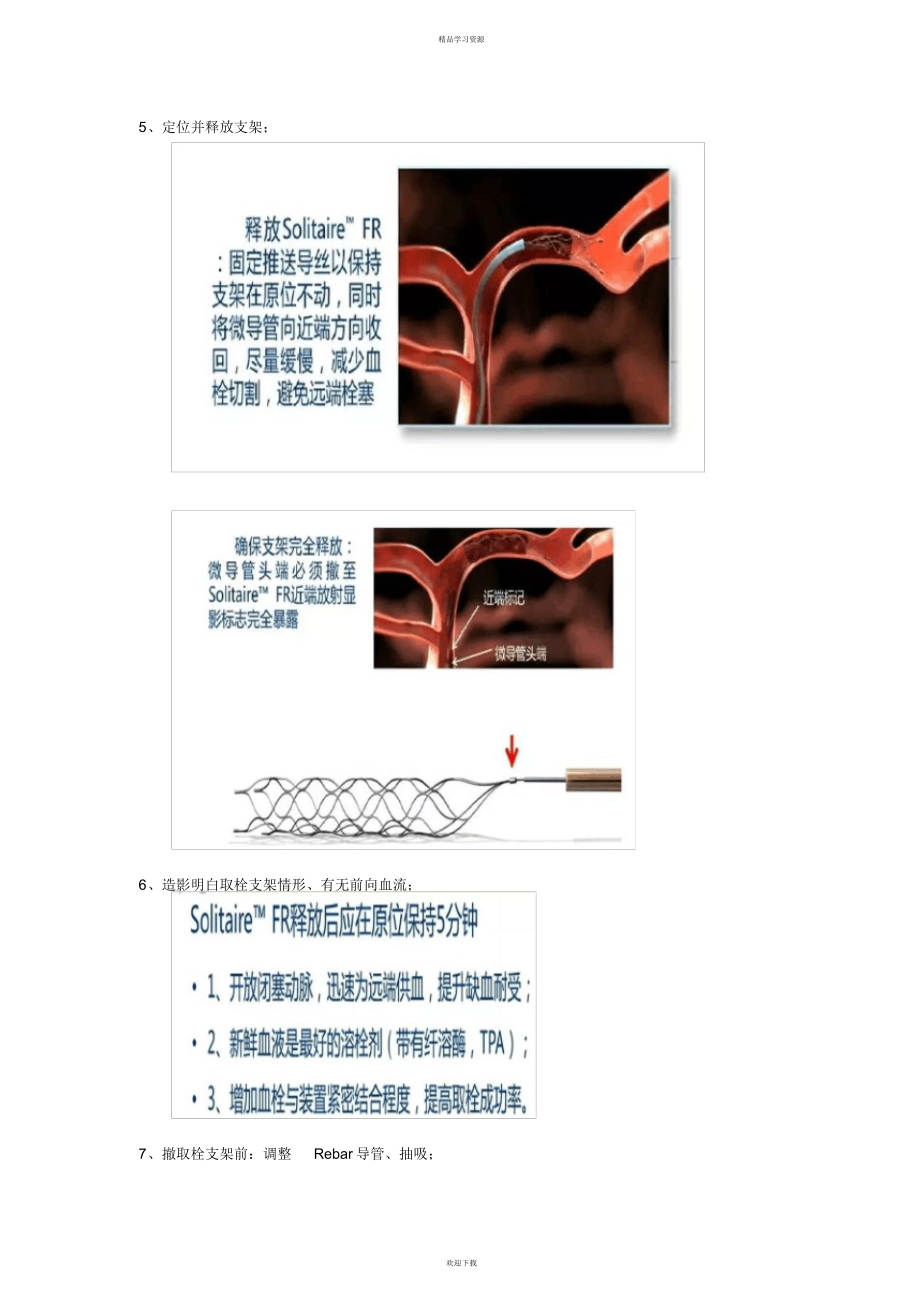 2022年机械开通——器械与操作_第3页