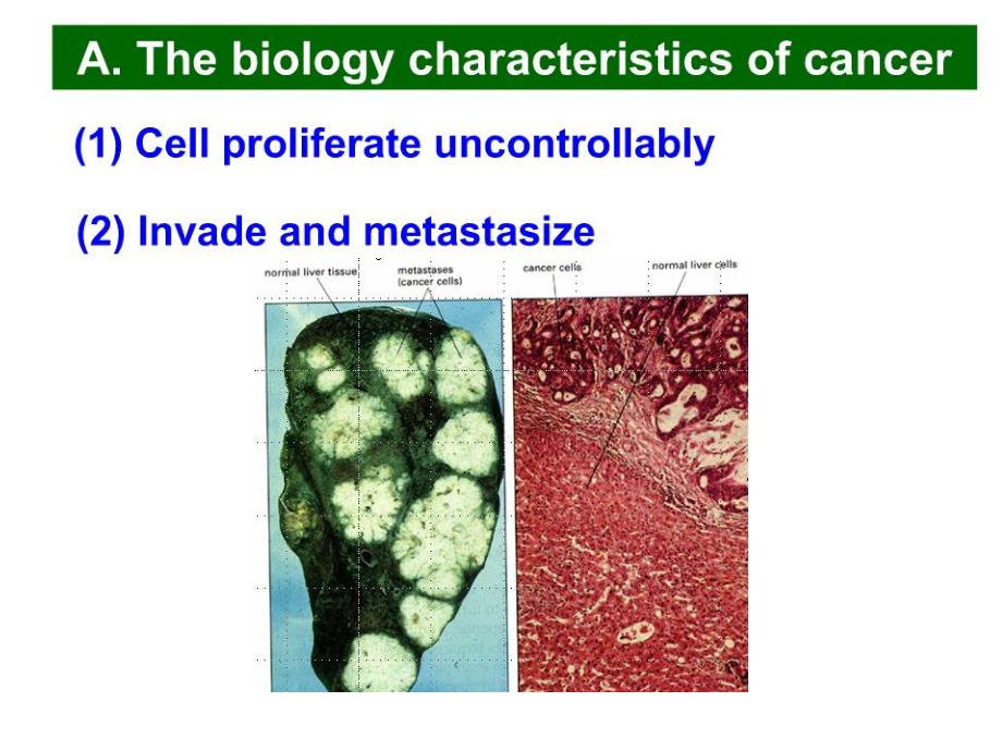 内蒙古大学细胞生物学双语课件12-2细胞的增殖调控与癌细胞2_第4页