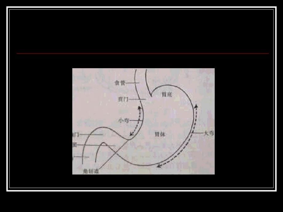 胃十二指肠疾病4教程教案_第5页