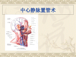 中心静脉置管术医学技术讲解