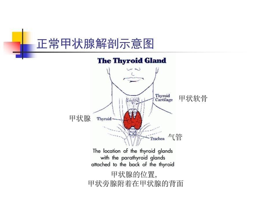 医学医学甲状腺功能亢进症知识讲解_第5页