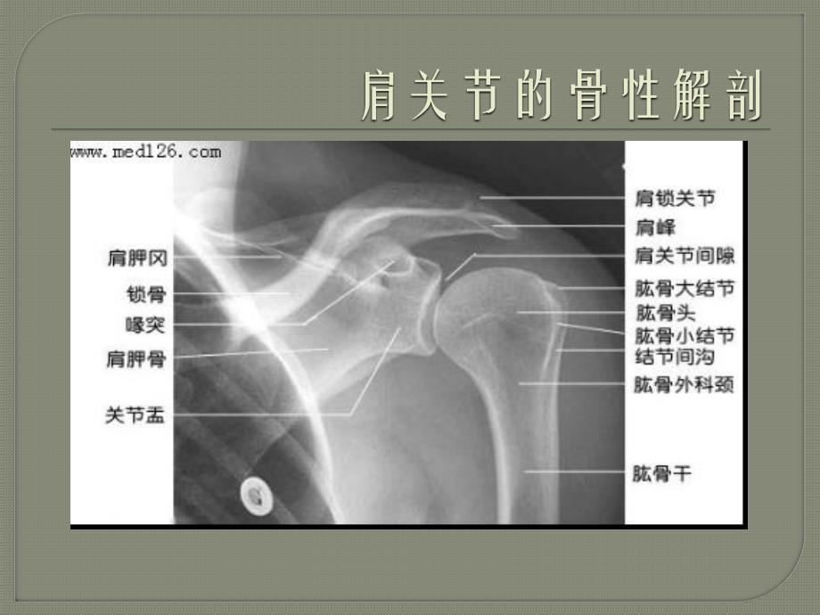 肩关节肩袖撕裂_第3页