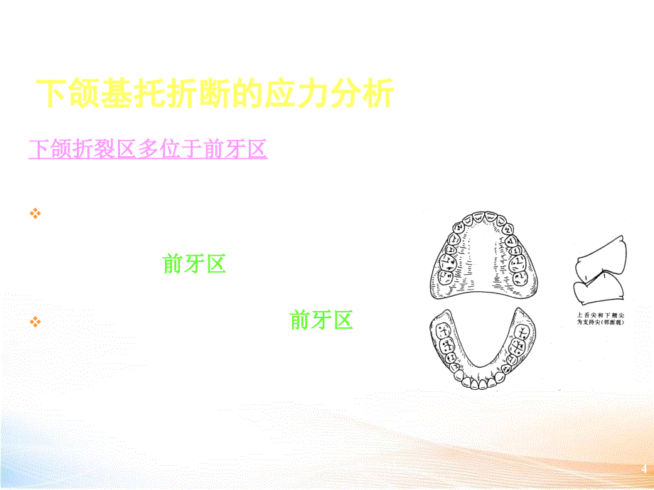 全口义齿的修理口腔修复学 课件_第4页