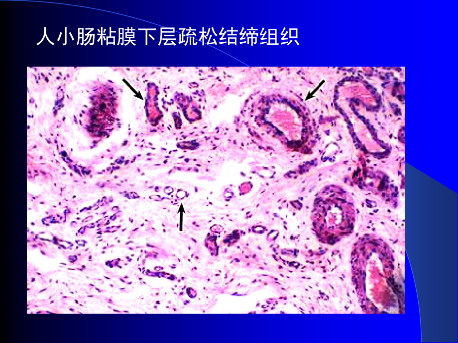 结绨组织-与--软骨课件_第5页