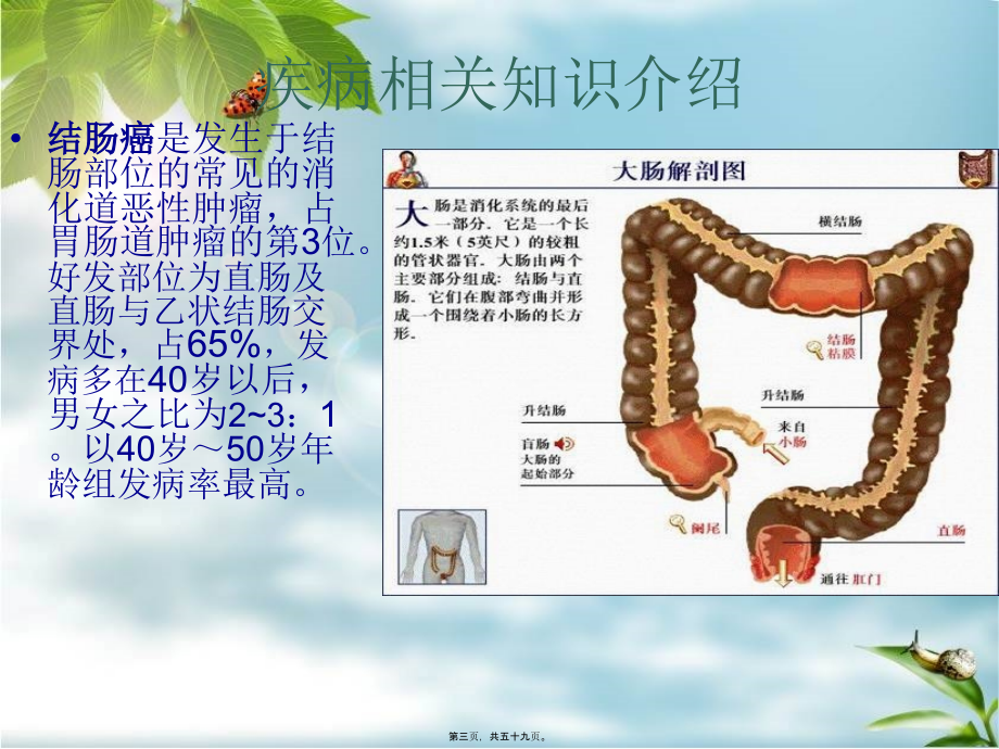 9月-结肠癌概述_第3页