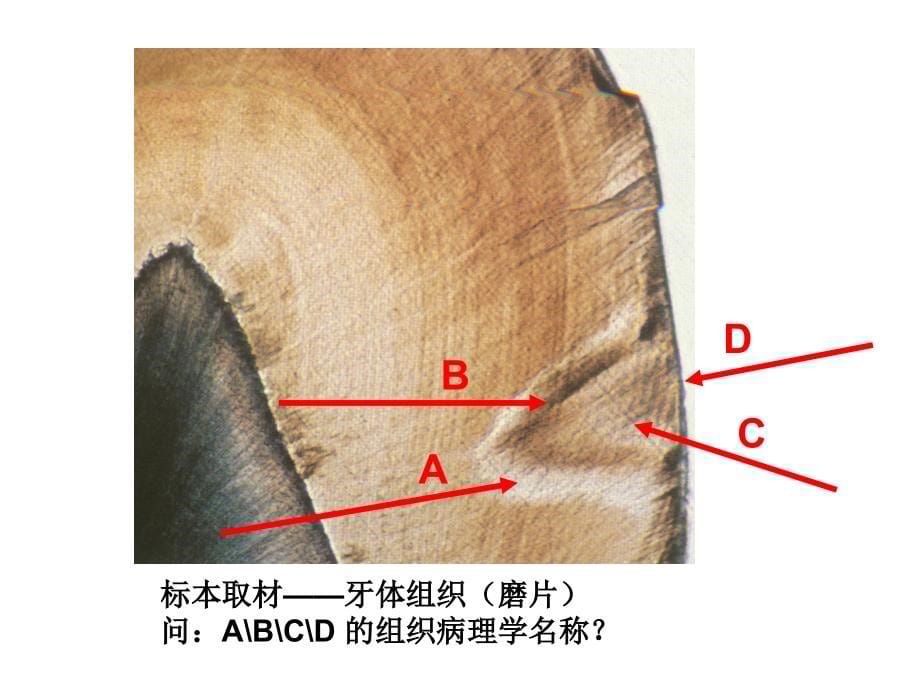 问根据该患者的临床表现判断为何种疾病（名称）_第5页